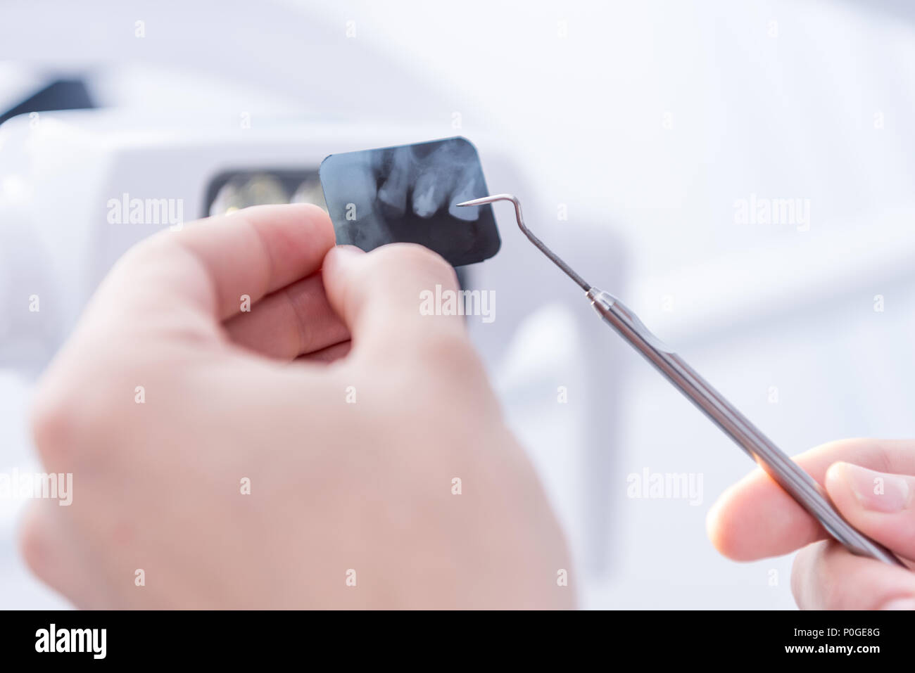 cropped shot of dentist pointing at xray picture of teeth with dental