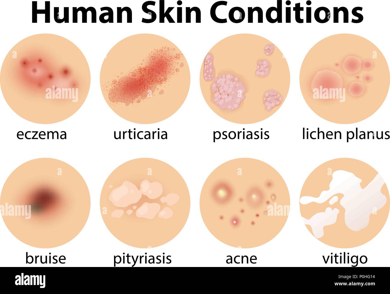 Medical Term For Hard Skin Hard Lump Under The Skin Causes And Medical Term For Hard Skin Hard Lump Under The Skin Causes And