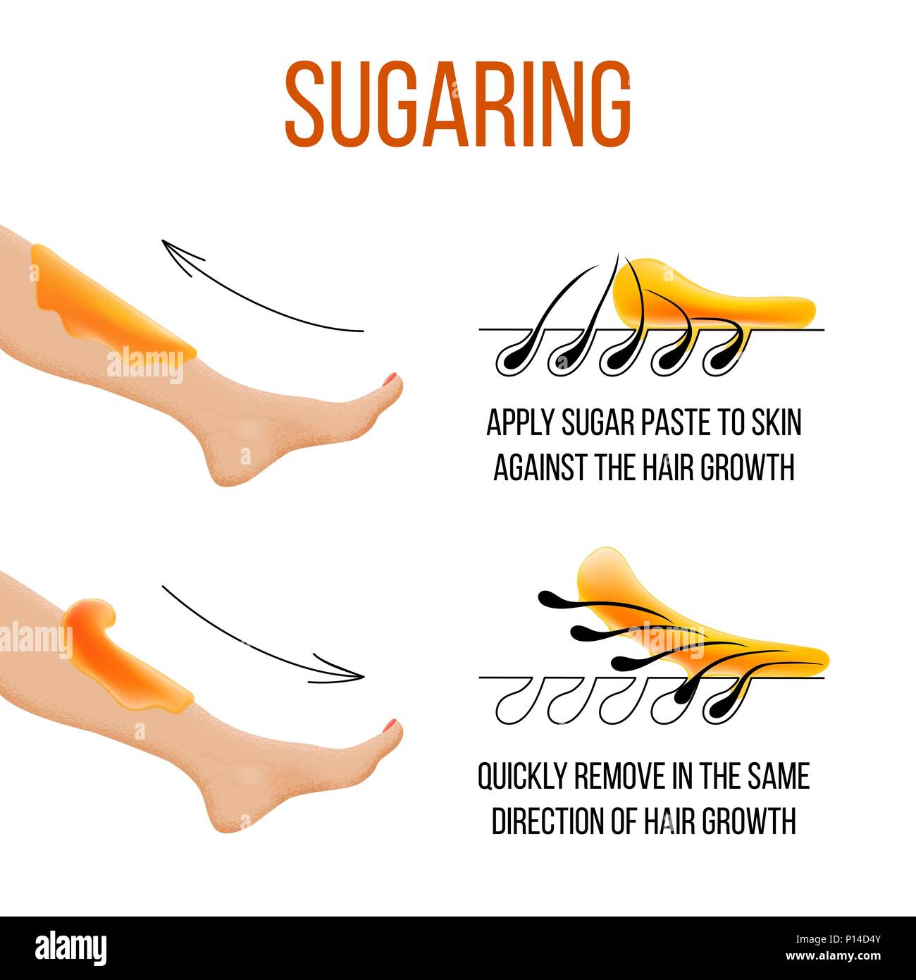 Depilation and sugaring. Hair removal. follicle. Woman leg with sugar or wax. Before and after. Process and steps of depilation. vector illustration Stock Vector