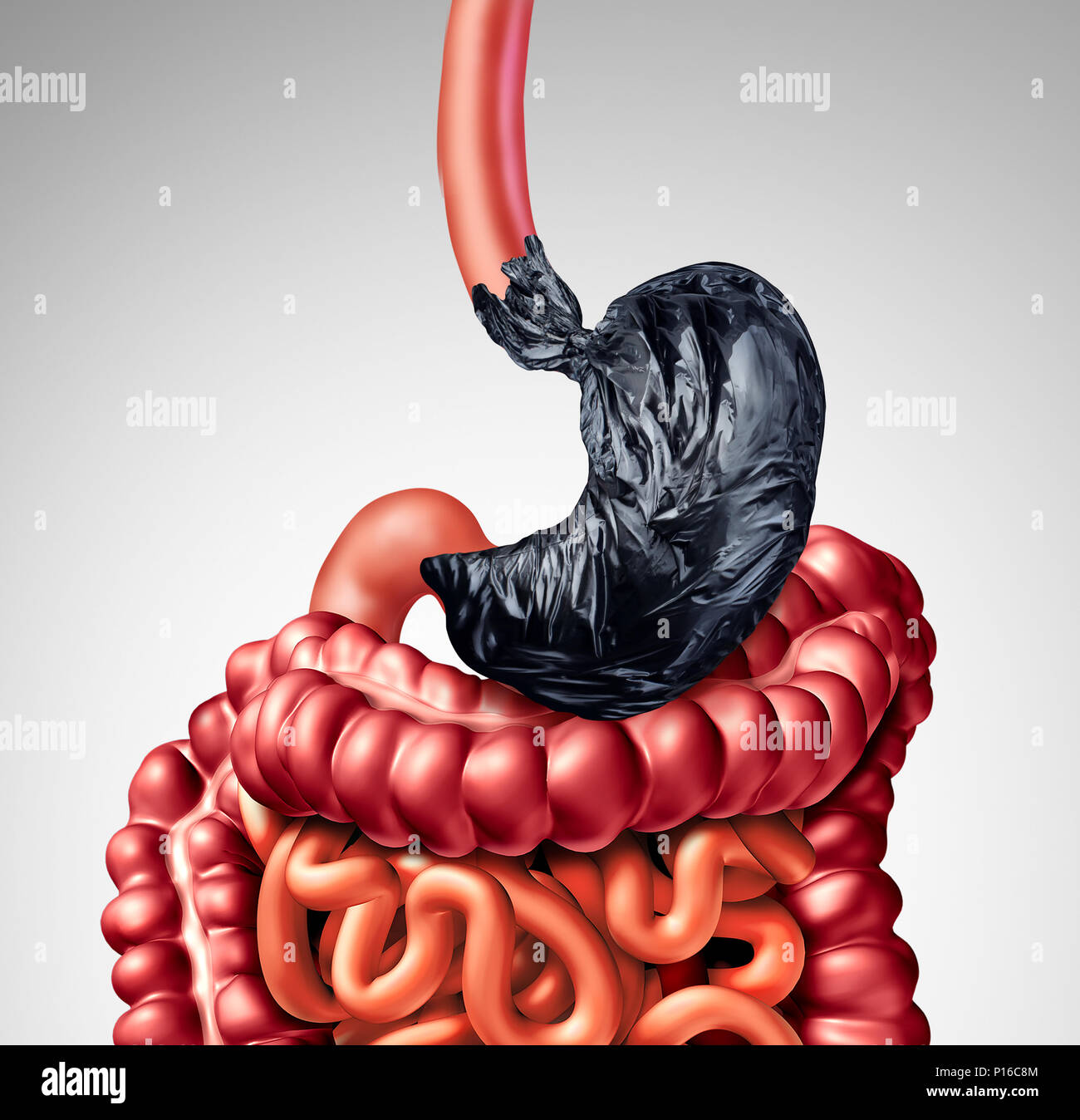 Human digestion problem as a stomach shaped as a garbage bag with the intestine organ as a symbol for indigestion pain in the digestive. Stock Photo