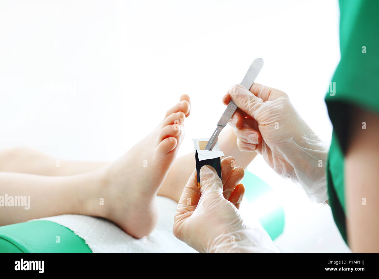 Callus feet hires stock photography and images Alamy