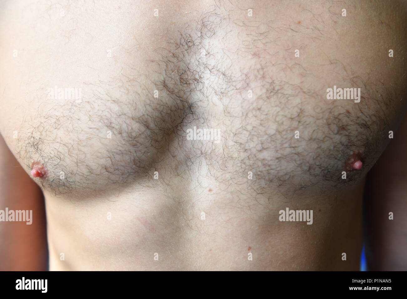27 May 2018 Germany Munich Black Chest Hair Seen On A Man In A Sports Centre Photo Felix Horhager Dpa Stock Photo Alamy