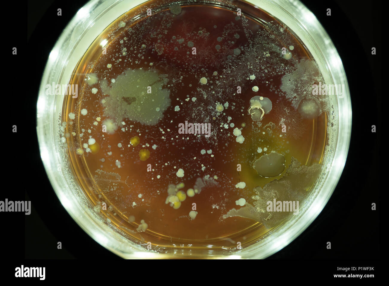 Petri Dish Bacteria Identification