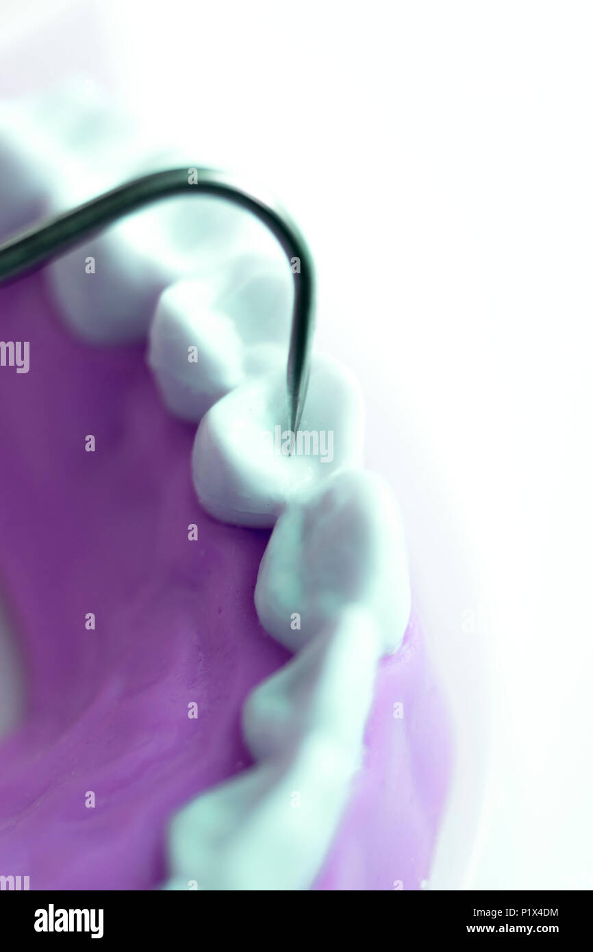 Dentist cleaning teeth with titanium metal tooth pick instrument to