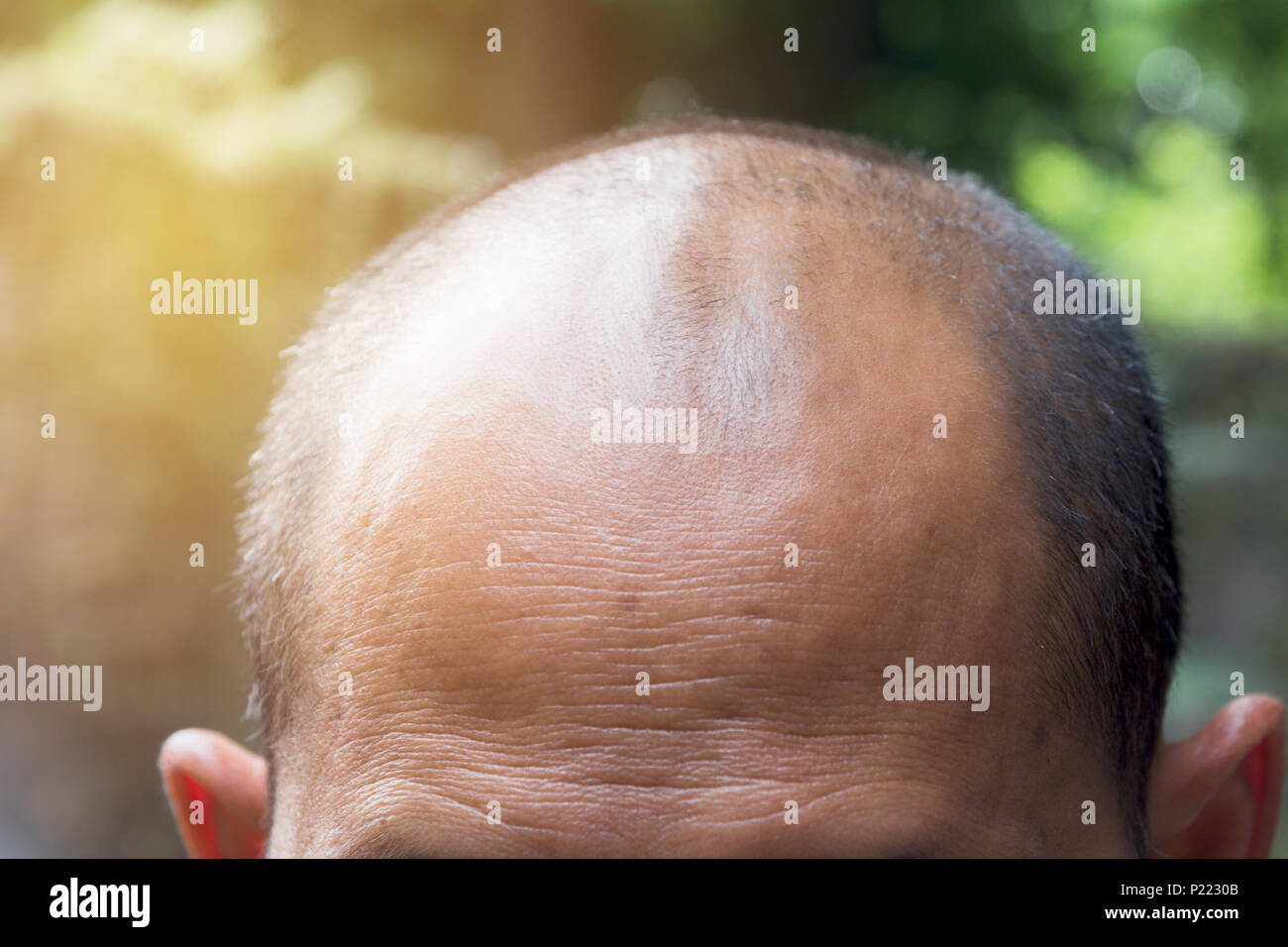 Head of man lose one's hair, glabrous on his head for elderly man. Stock Photo
