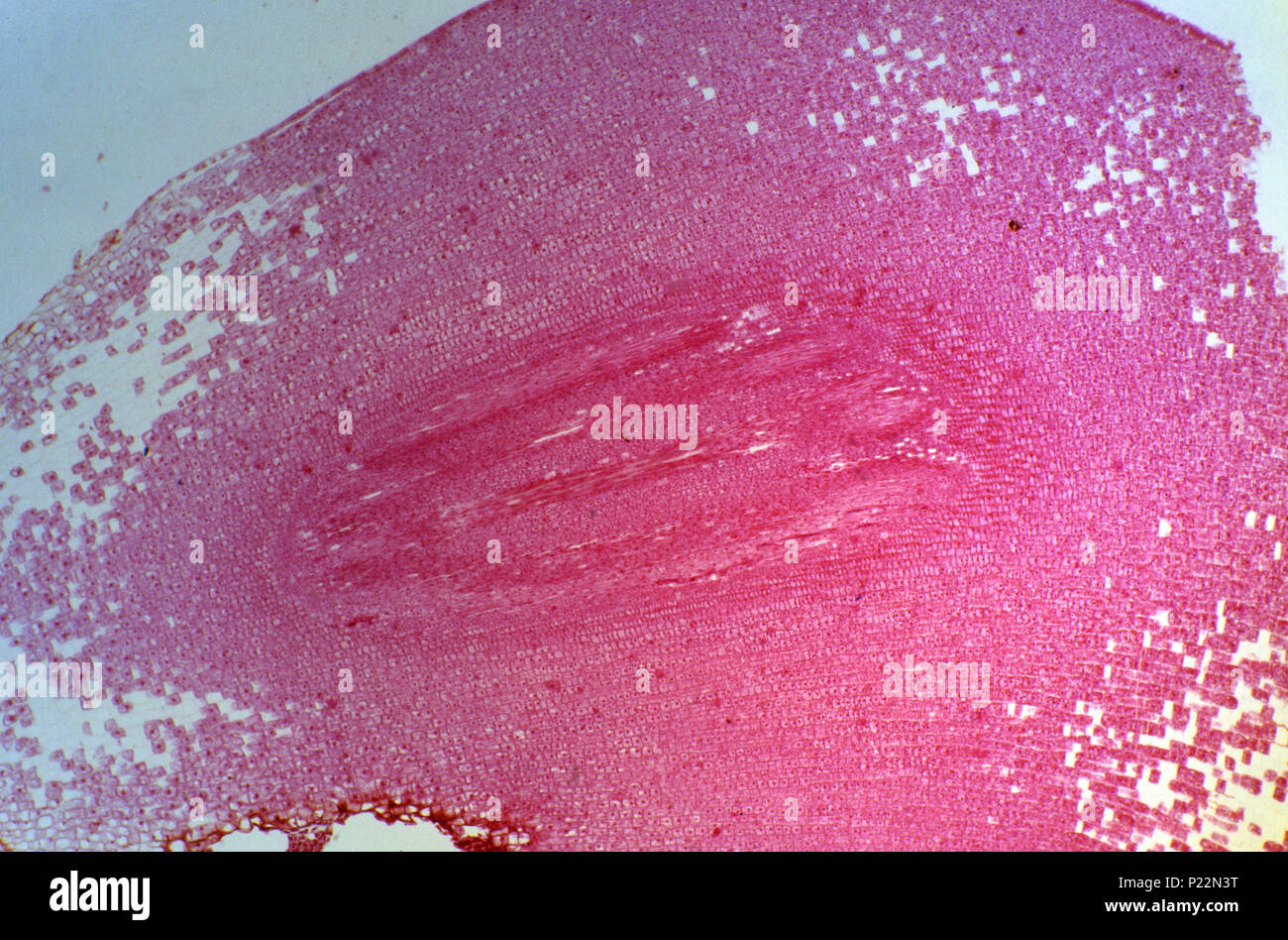 Nucleolus. 8x Stock Photo