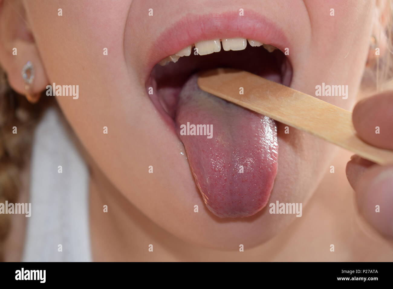 throat examination Stock Photo