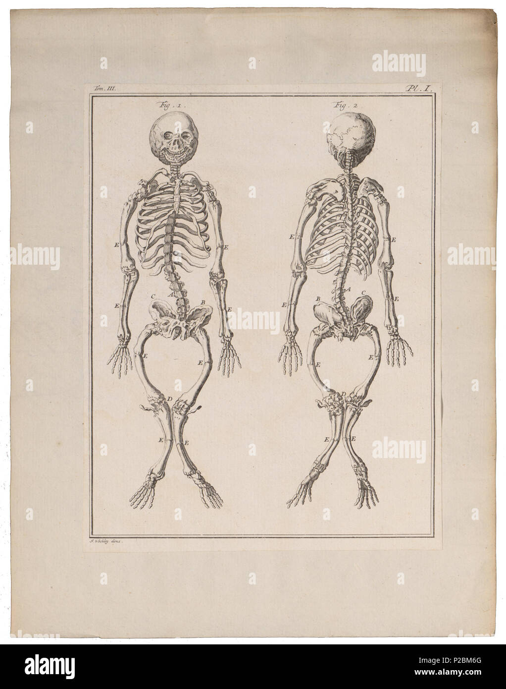 Rickets symptoms hi-res stock photography and images - Alamy