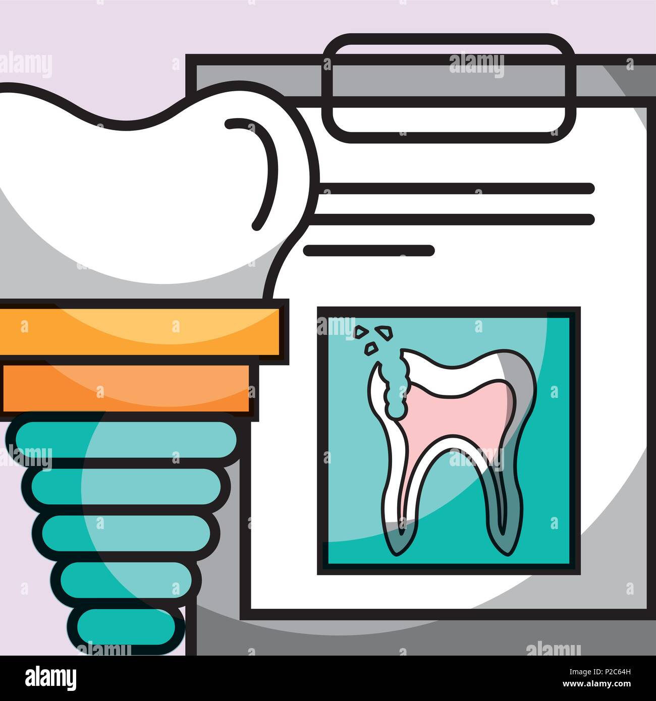 dental implant clipboard broken tooth report Stock Vector Image & Art