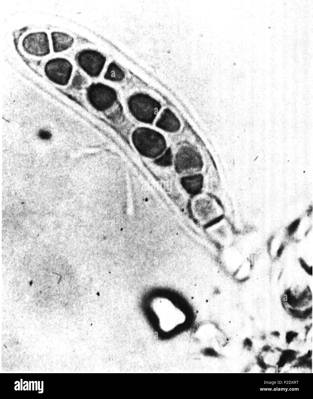 7 Bitunicate ascus and ascospores of Didymella rabiei Stock Photo