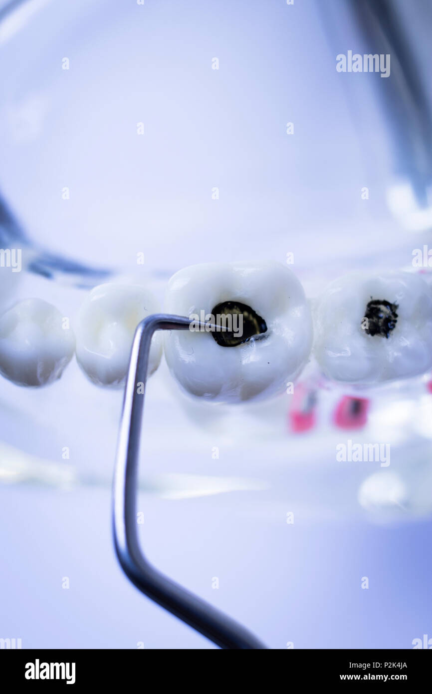 Dentist cleaning teeth with titanium metal tooth pick instrument to