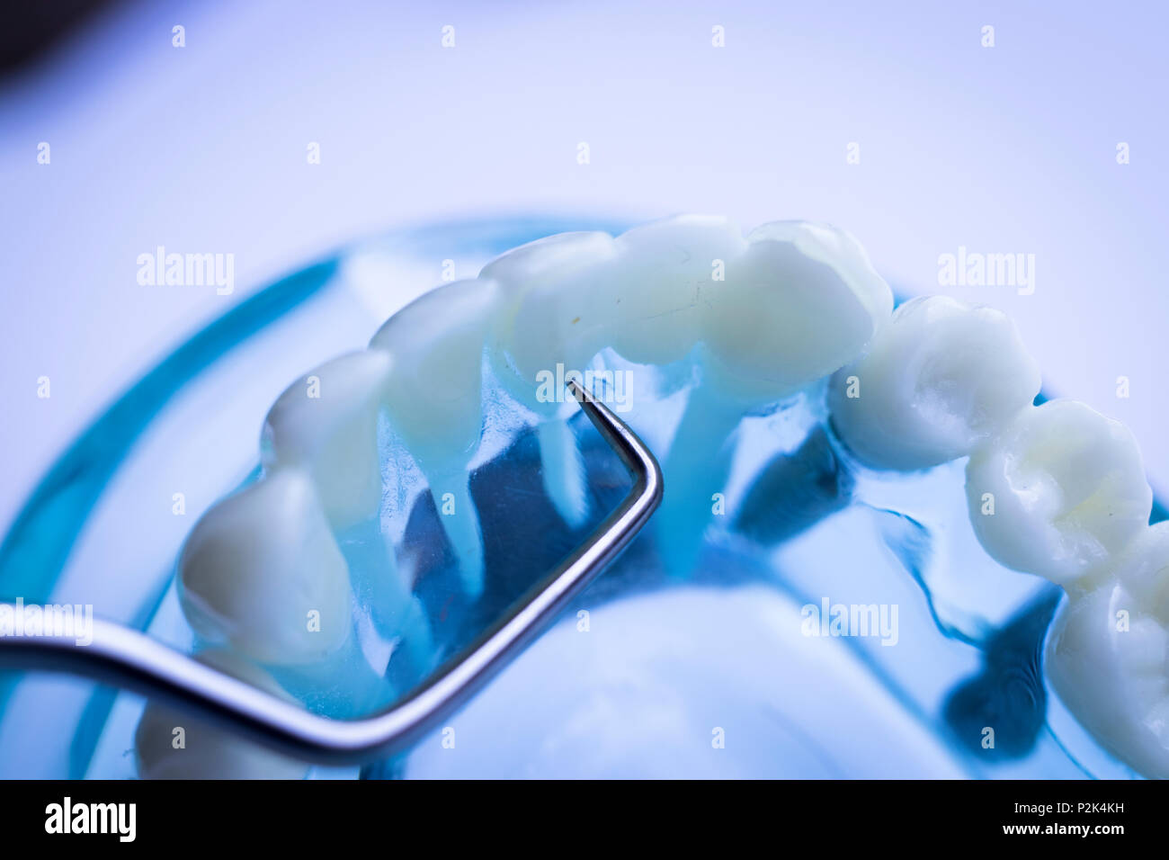 Dentist cleaning teeth with titanium metal tooth pick instrument to