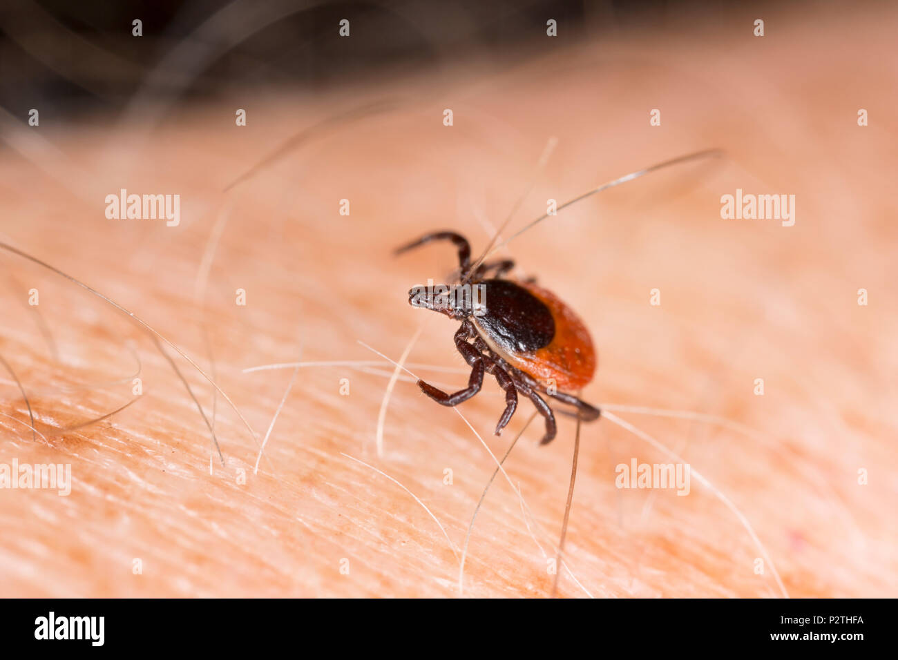 A female tick, Ixodes ricinus, crawling on a human arm. It was found in an area where deer and other mammals are present. This tick is also known as a Stock Photo