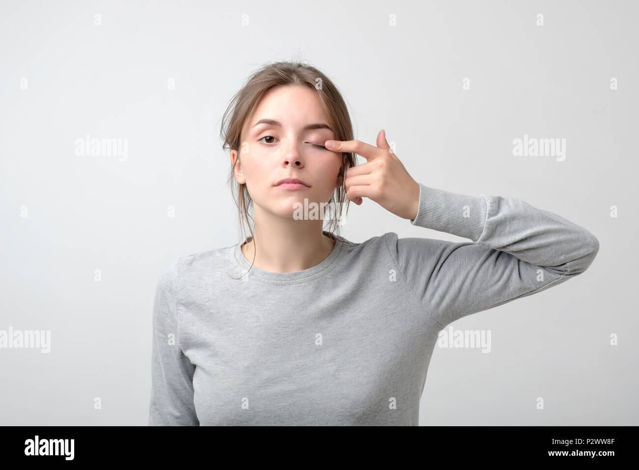 The woman is touching her eye to show that she has problem with eyesight. Health trouble. Concept of miopia or astigmatism Stock Photo