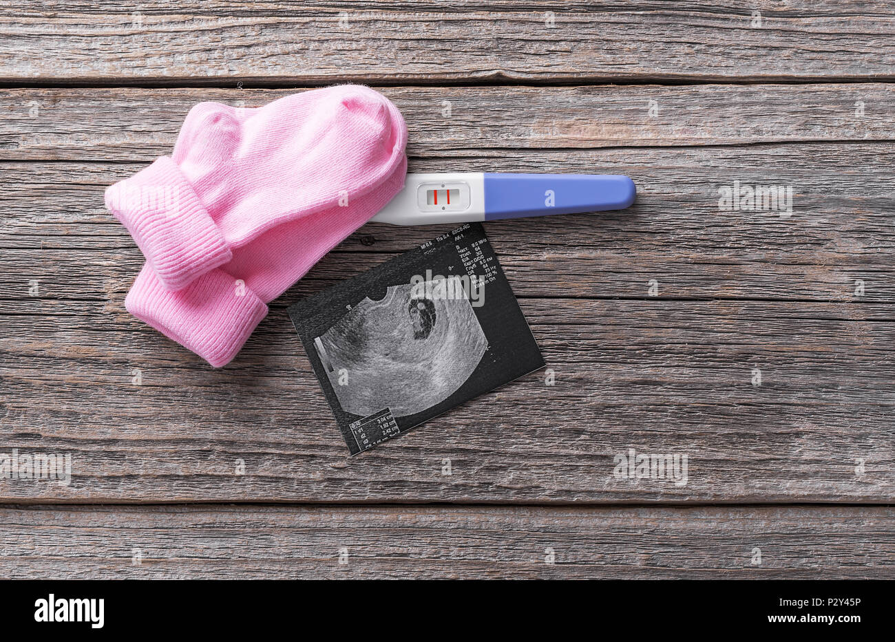 Pregnancy test and baby socks picture of the embryo. Stock Photo