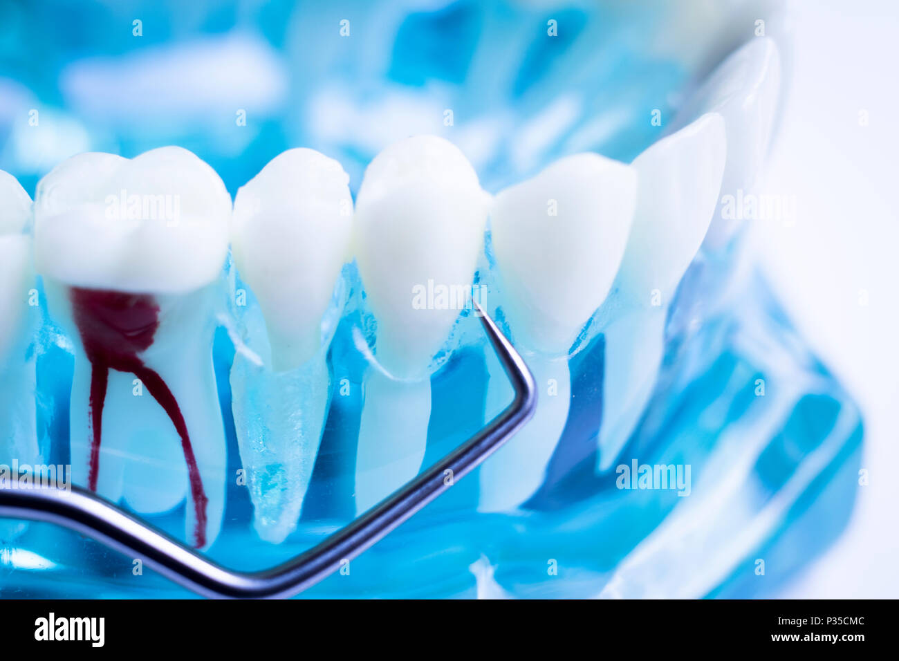 Dentist cleaning teeth with titanium metal tooth pick instrument to