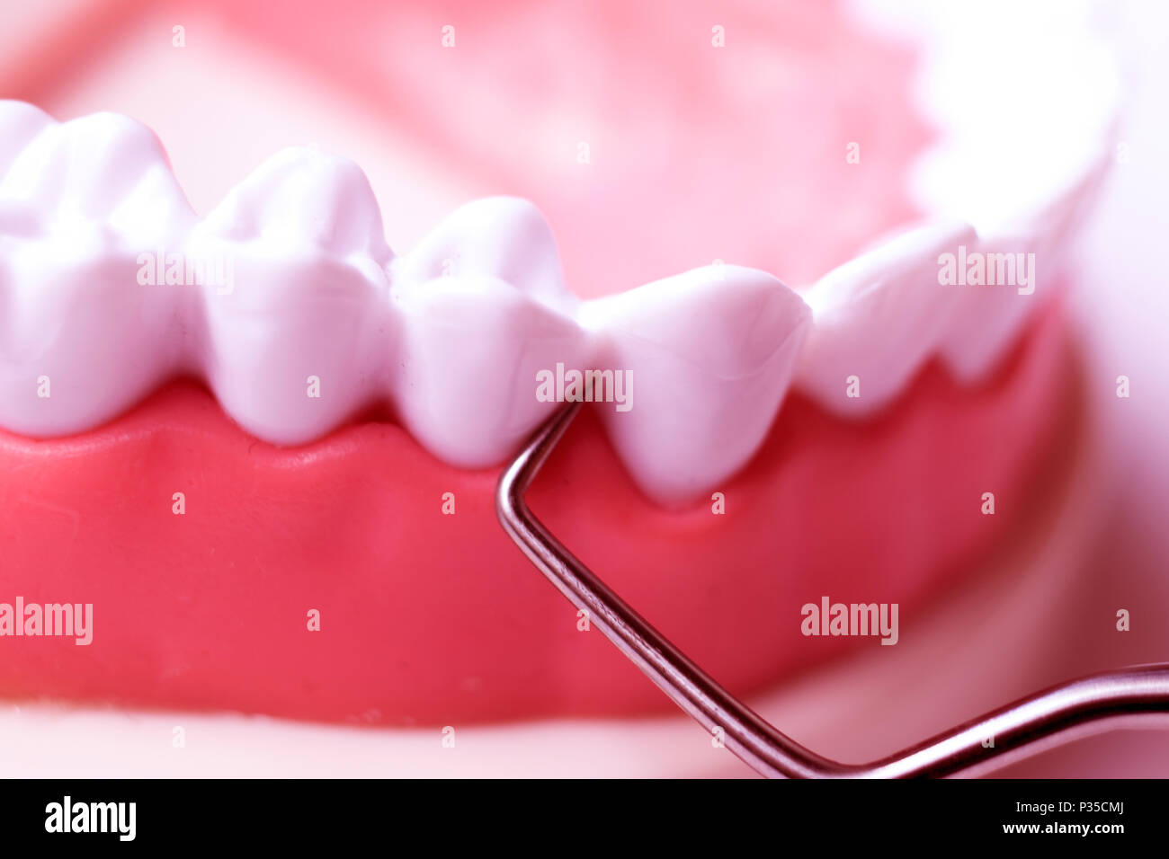 Dentist cleaning teeth with titanium metal tooth pick instrument to