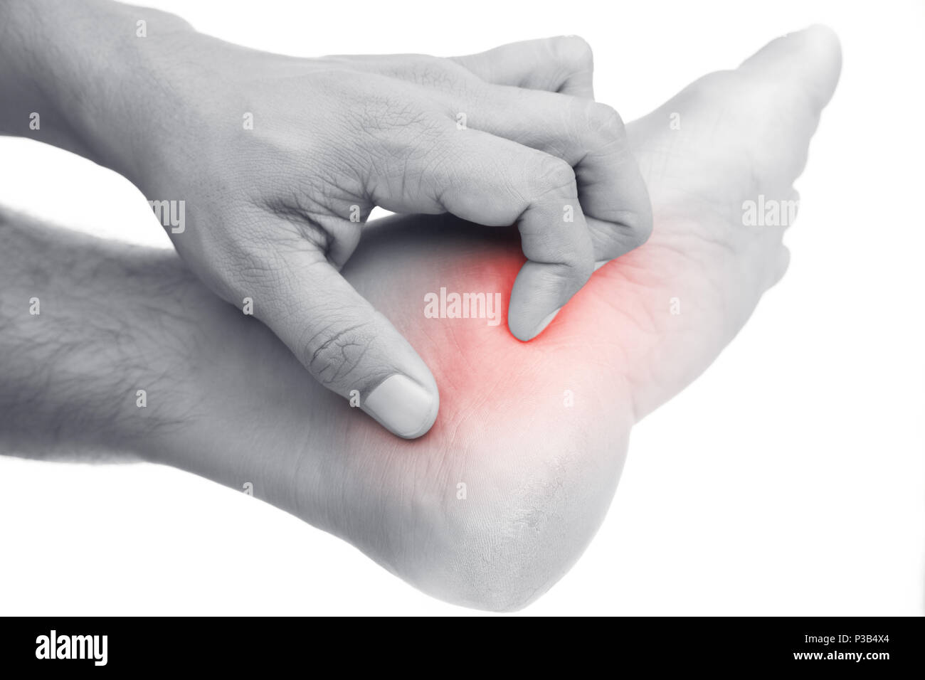 Itching foot isolated on white background Stock Photo Alamy