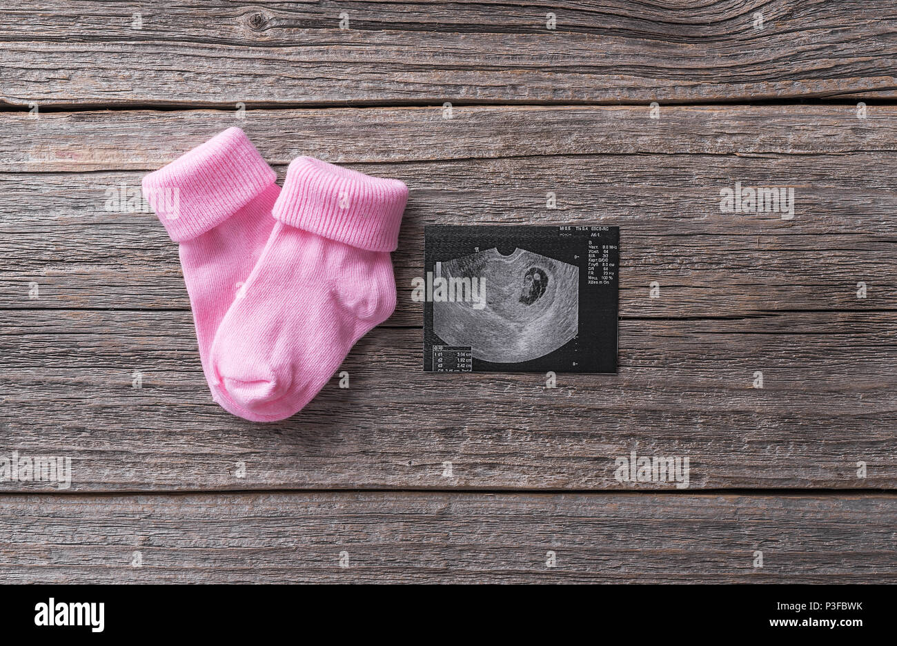 Baby socks picture of the embryo. Stock Photo