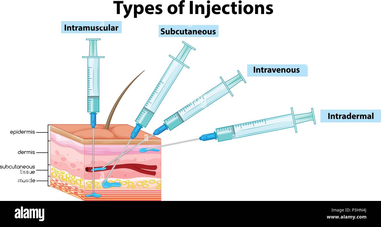 Types of Injections on White Background illustration Stock Vector Image