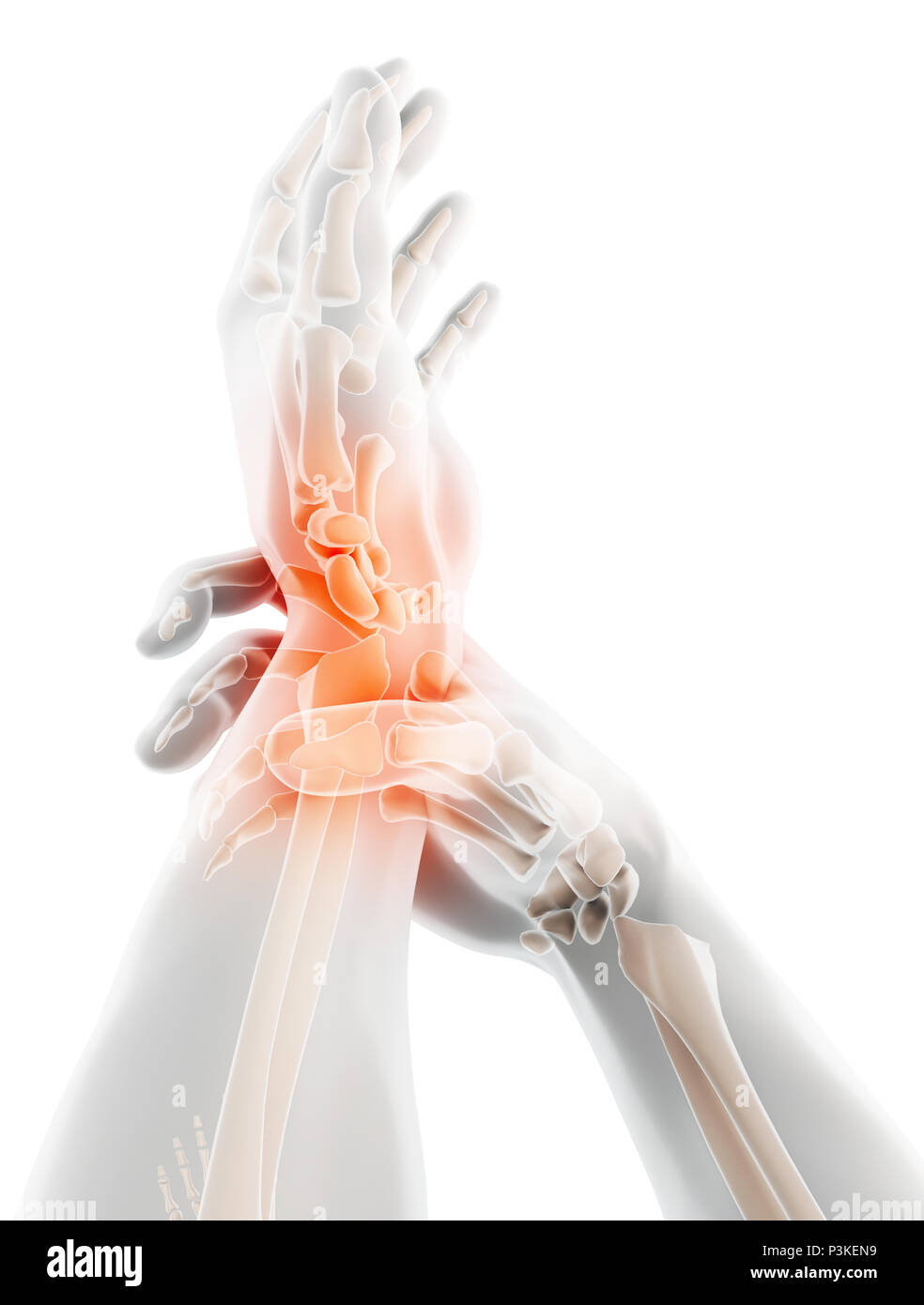 3d image wrist joint hi-res stock photography and images - Alamy