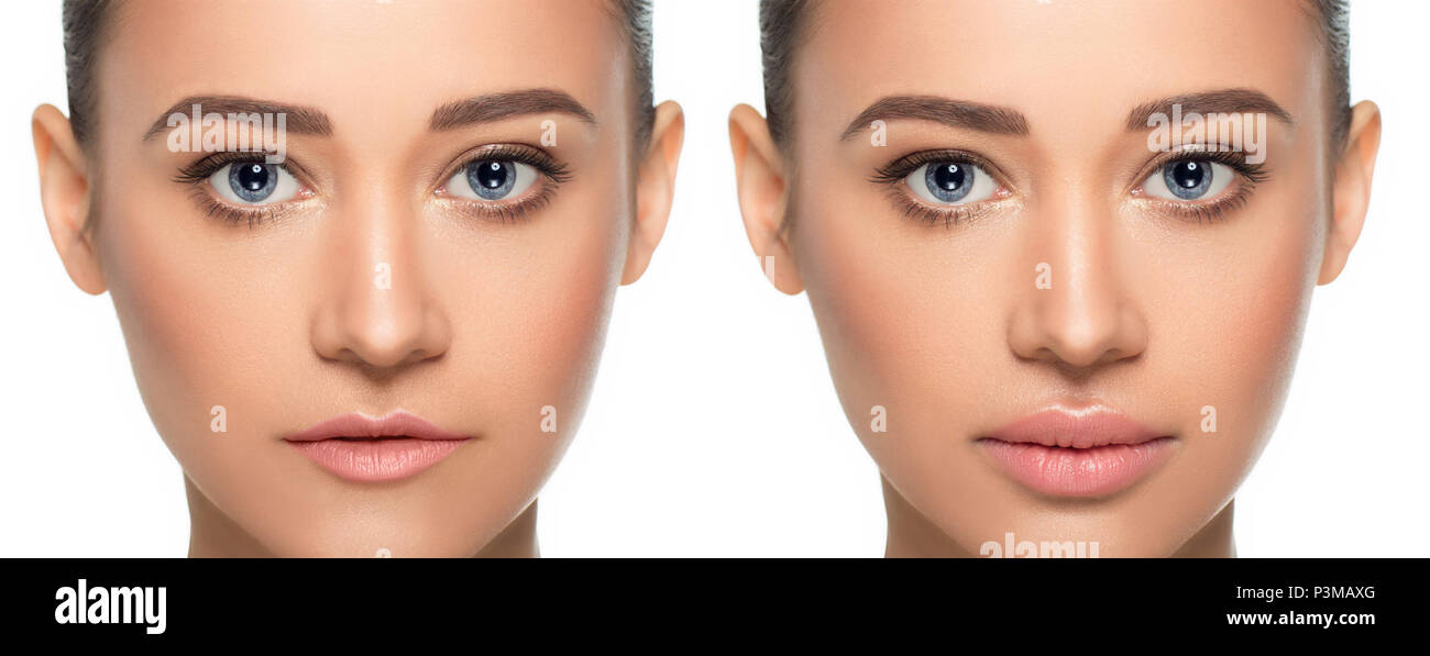 Female face before and after procedure lips augmentation Stock Photo ...