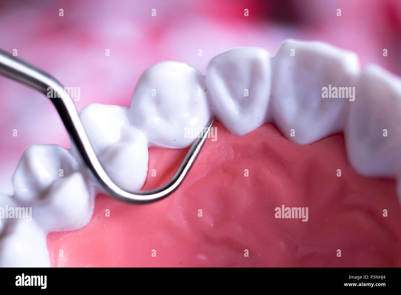 Dentist cleaning teeth with titanium metal tooth pick instrument to