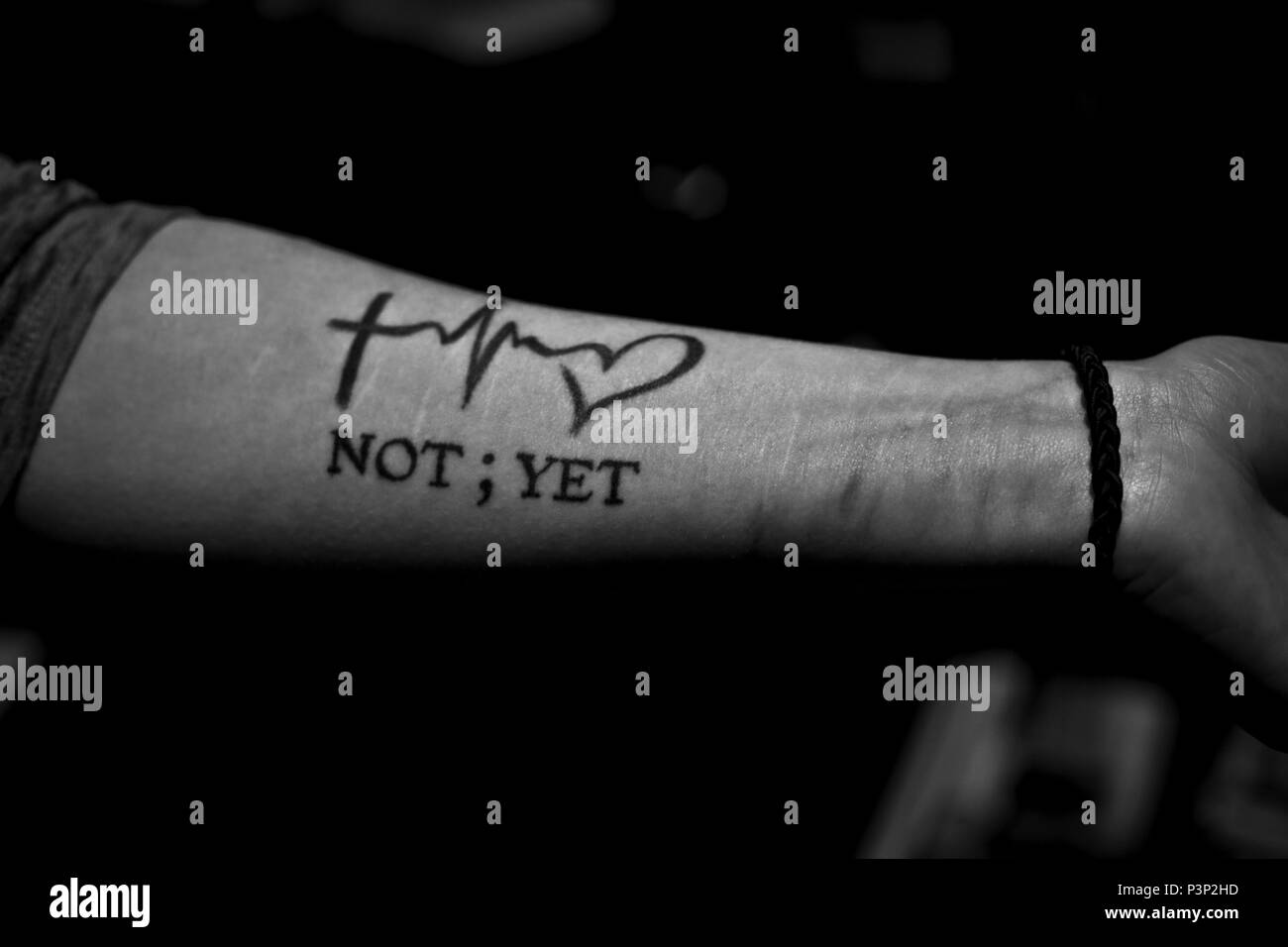 Rachel Miller, 30, holds up her scarred arm and anti-suicide tattoo, July 19, 2016. Miller has suffered for years from mental health issues, and had attempted suicide in the past. She and her boyfriend Matt Nichol are both on disability, and live in a small one bedroom apartment in Cortland, N.Y. Nearly one in three residents of Cortland are at or below the poverty line. Miller and Nichol attended the Healthy Cortland Innovative Readiness Training event aimed at Cortland residents, which included military service members providing no cost medical, dental, optometry, and veterinary care. (U.S.  Stock Photo