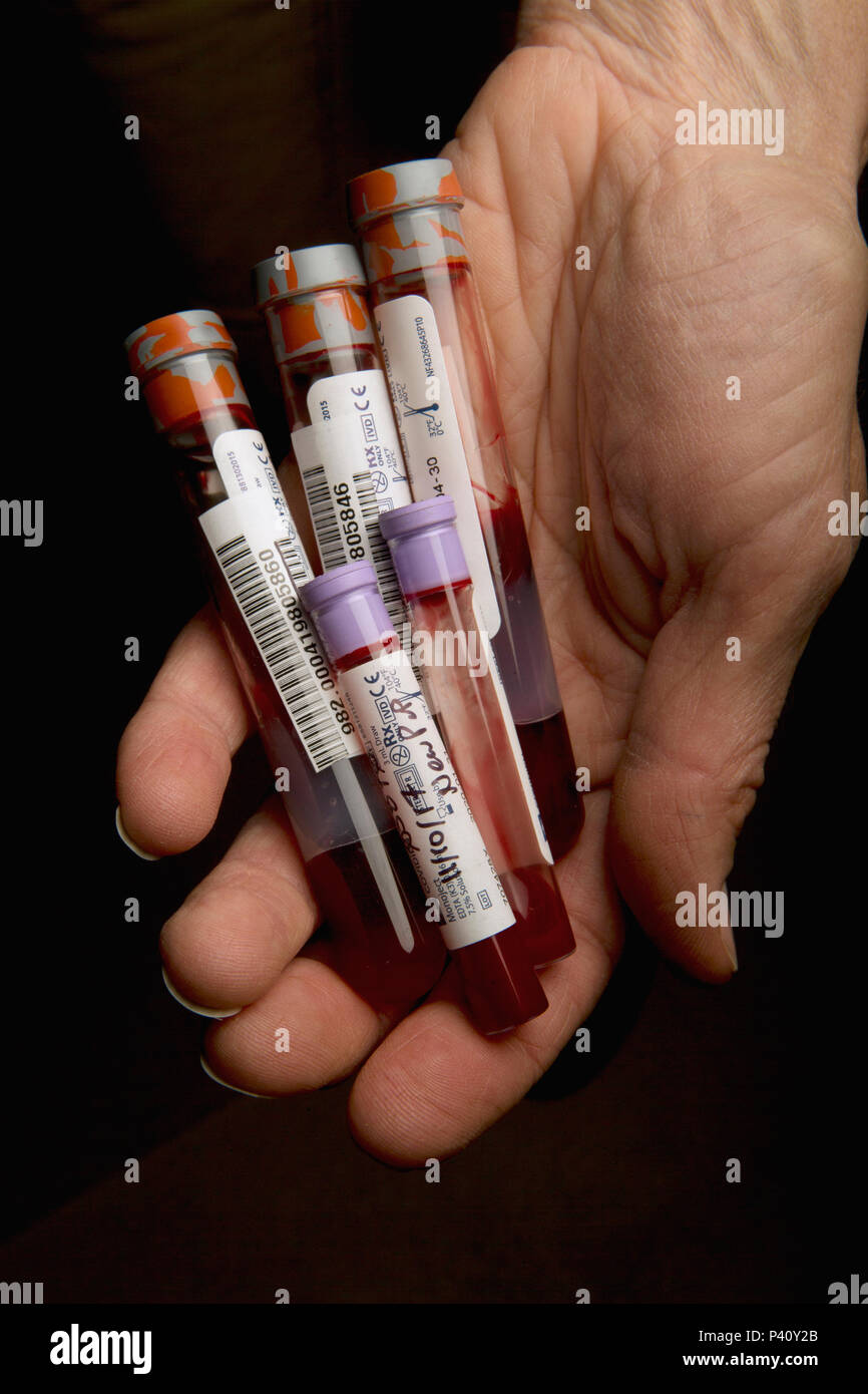 Santa Catalina Island Fox (Urocyon littoralis catalinae) biologist