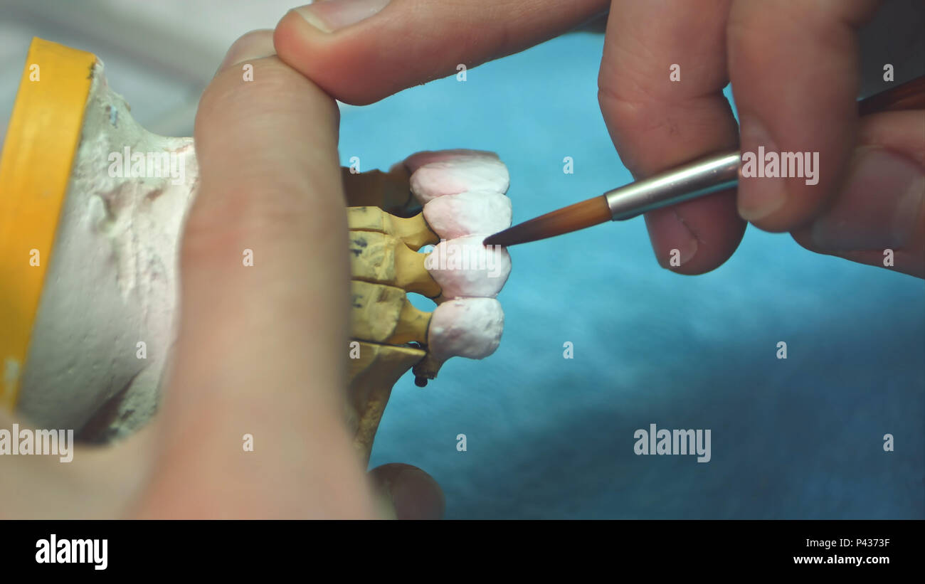 Dental technician applying ceramics glaze to a cast made with CNC