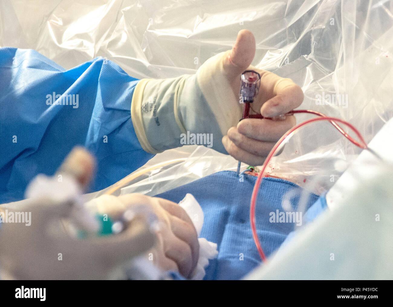 Catheter guidelines hi-res stock photography and images - Alamy