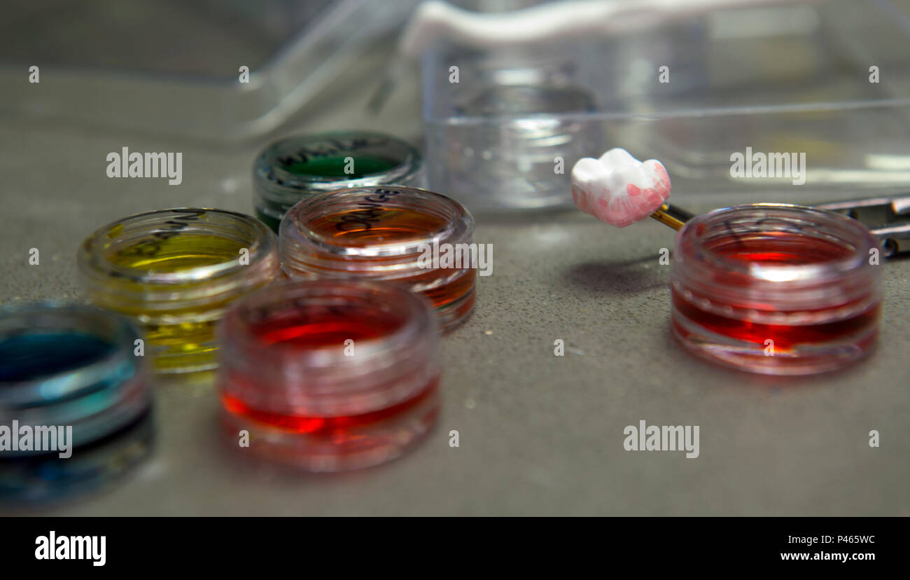 Zirconia teeth hires stock photography and images Alamy