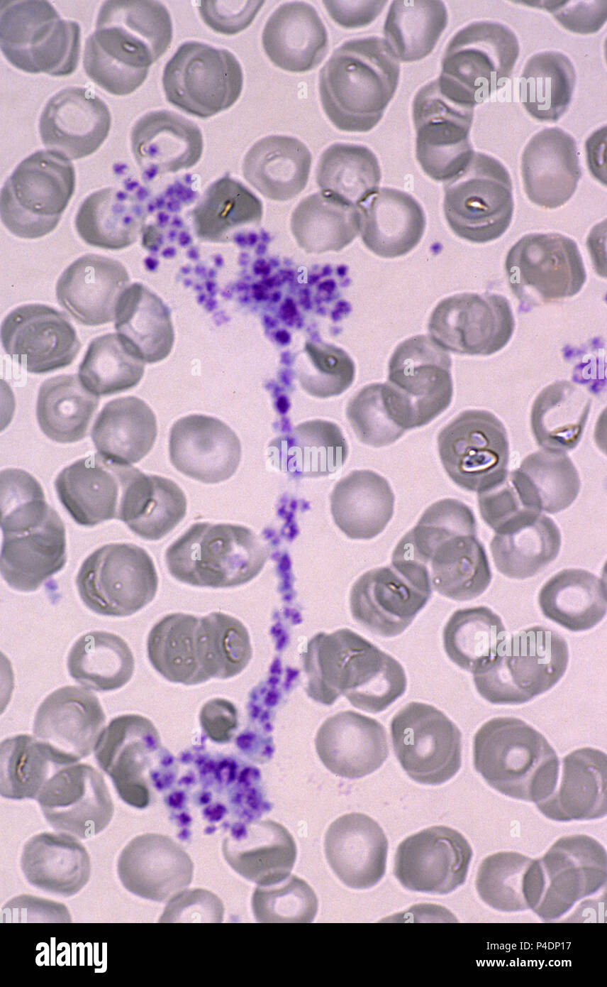 Platelets under microscope