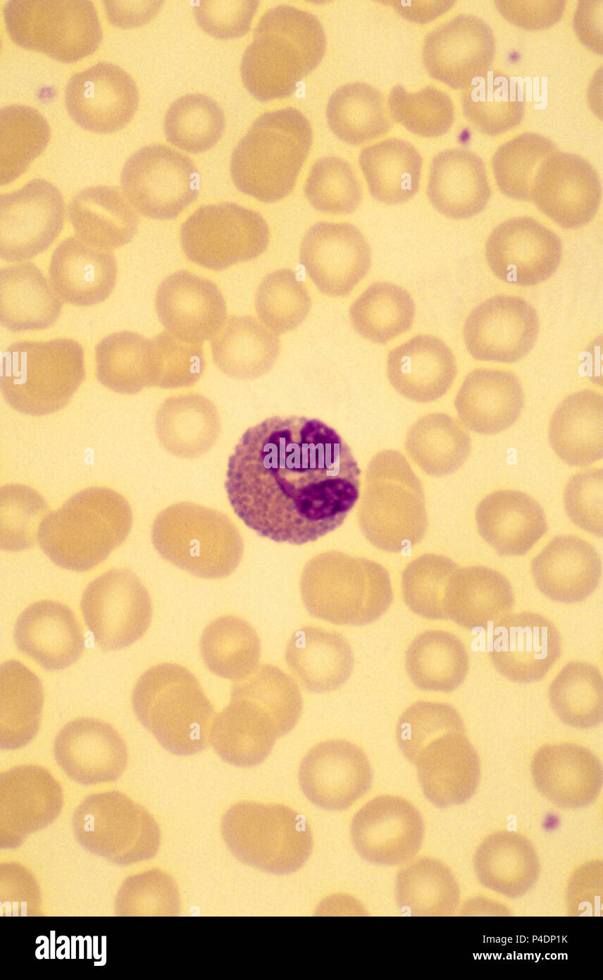 White blood cell, Eosinophil Stock Photo