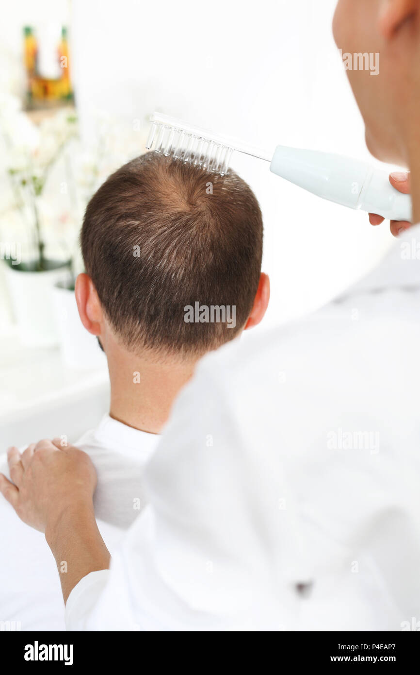 Needle mesotherapy of the scalp. Microneedle mesotherapy of the scalp. The head of a man with