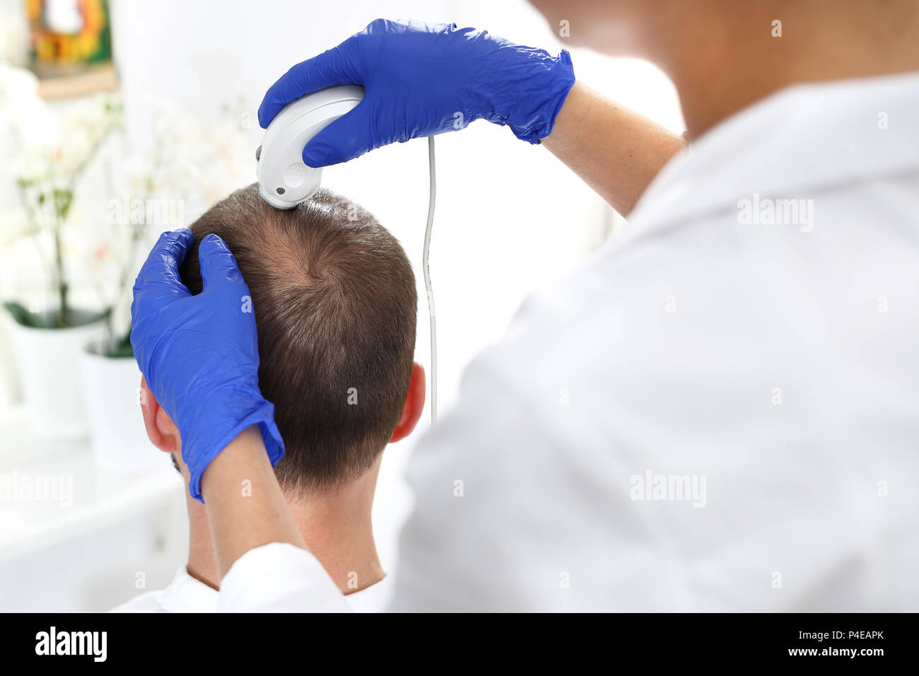 Microscopic analysis of the condition of hair and scalp. The head of a