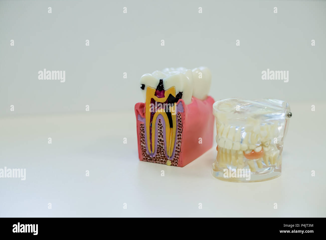 Concept of overconsumption, excessive candies, sugar consumption and