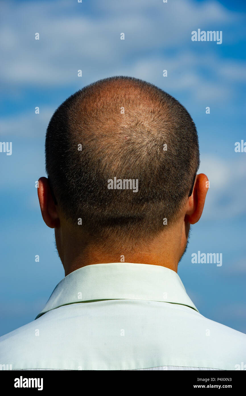 Balding Head Back View Stock Photos And Balding Head Back View Stock