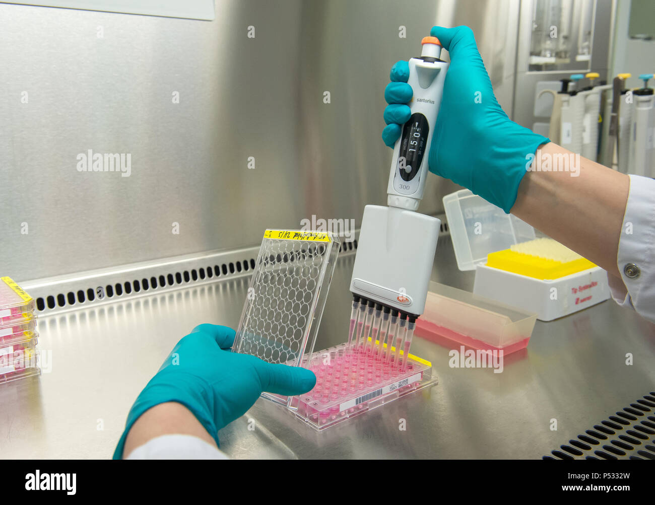 Preparation samples 96 well pcr plate within elisa diagnostics hires