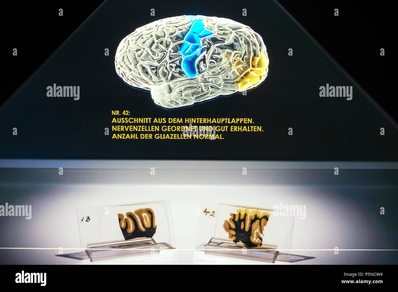 Two histological sections from the brain of Albert Einstein (1879-1955) below and a three-dimensional hologram of his brain shown in the exhibition 'The Brain - Intelligence, Awareness, Feeling' in the LWL Museum of Natural History, Münster, Germany, Jujy 2018 (Lender: Mütter Museum, Philadelphie) Stock Photo