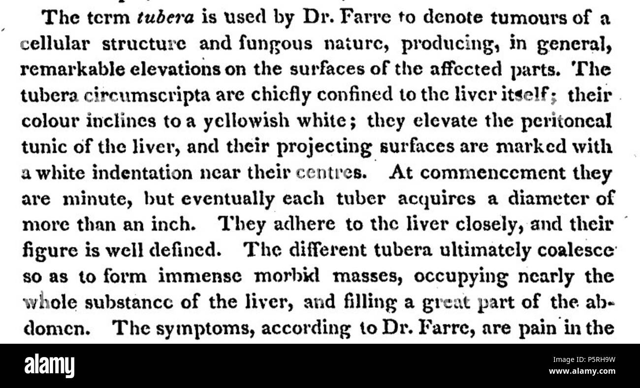N/A. English: Taken from page 3 of the PDF file shown in the source link, showing how spellings such as 'tumours' and 'colour', which are today considered to be British/Commonwealth spellings, were used in early American publications. This one dating from 1814. 1 January 1814. New England Journal of Medicine 236 British spellings in NEJM 1814 Stock Photo