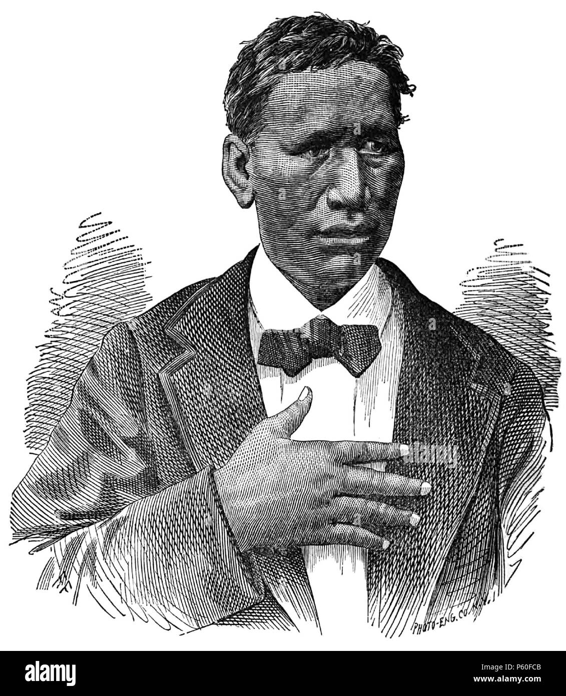 N/A. English: CASE XIII. (Photograph 11). The original photograph from which this book illustration is derived was taken by Henry L. Chase in 1878 as a part of the 'Report of the Special Sanitary Committee on the State of the Leper Settlement at Kalawao'. Image was republished in the The New Orleans Medical and Surgical Journal in April 1880 as part of a later medical examination by John Harrison Bemiss in 1879. CASE XIII. (Photograph 11.) Ephraim Kanoe, male, aged 30, native of Hawaii. His father is now seventy years old, and. strong ; his mother, 46 years of age; she is supposed to have had  Stock Photo