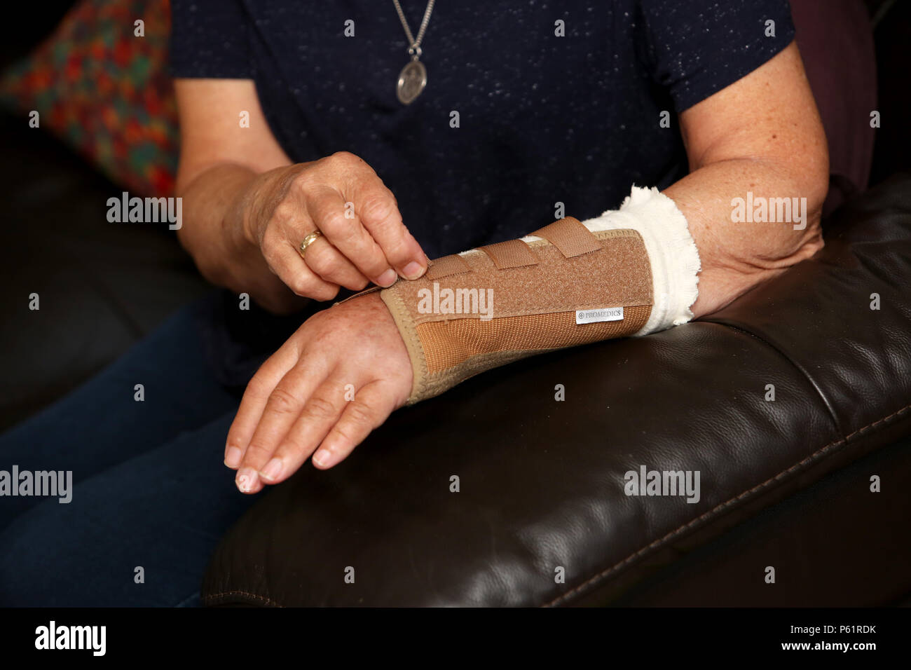 An older lady with a fractured arm pictured at her home in West Sussex, UK. Stock Photo