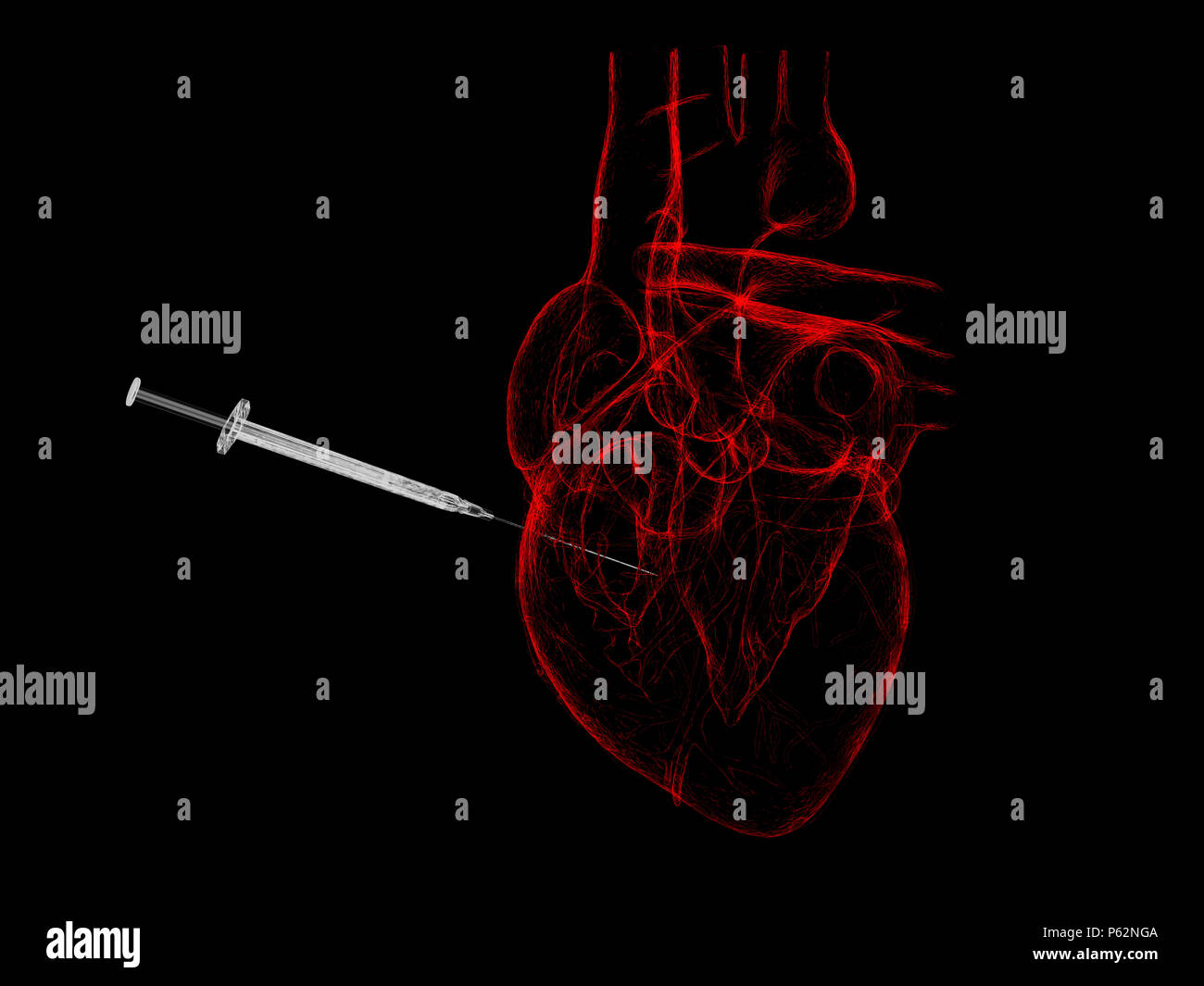 X Ray Red Injection Of Human Heart 3d Illustration On Black