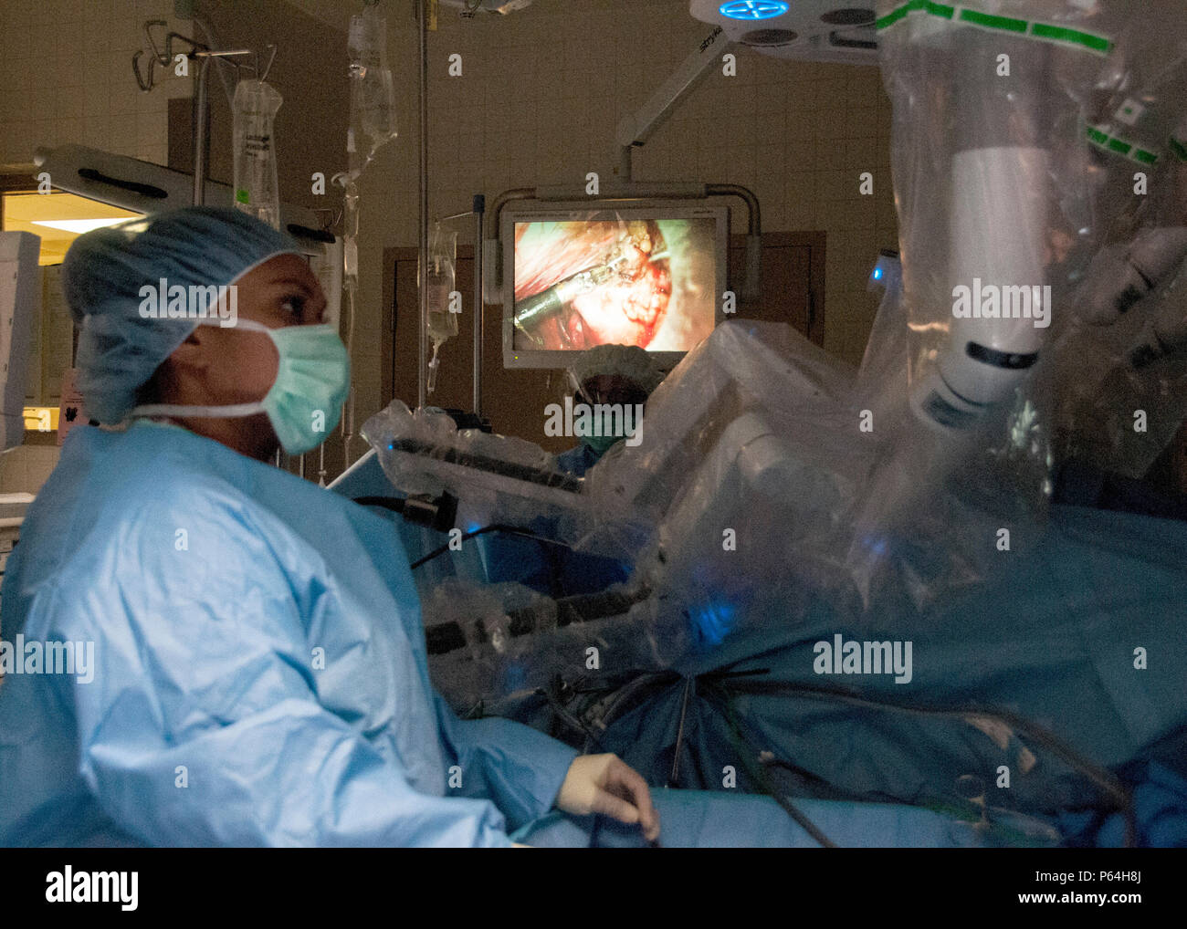 Robotic Surgery Incision Example Medical personnel perform the Department of Defense's first robotic ...