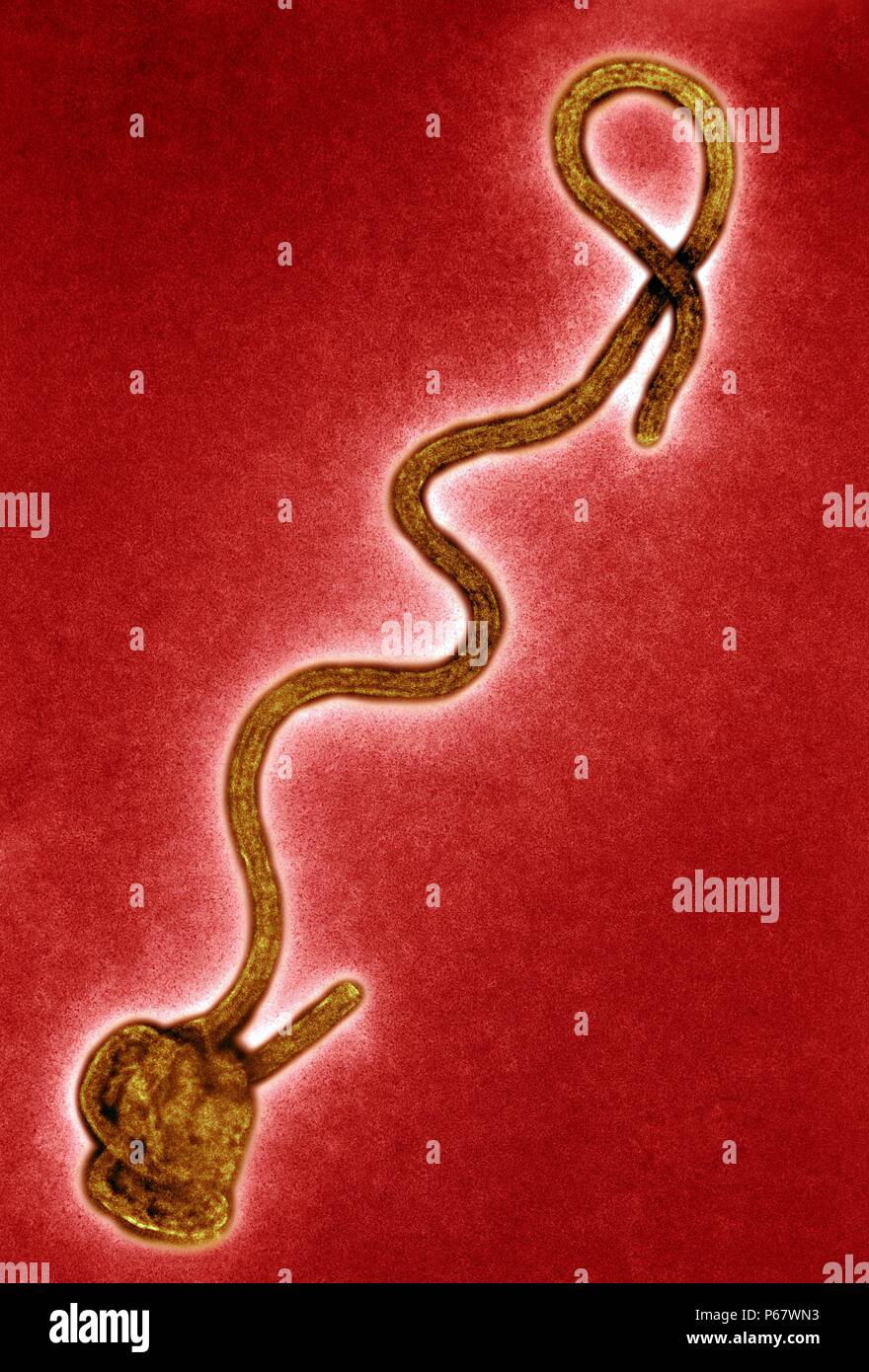 Transmission electron Micrograph of the Ebola Virus Hemorrhagic Fever RNA Virus Stock Photo