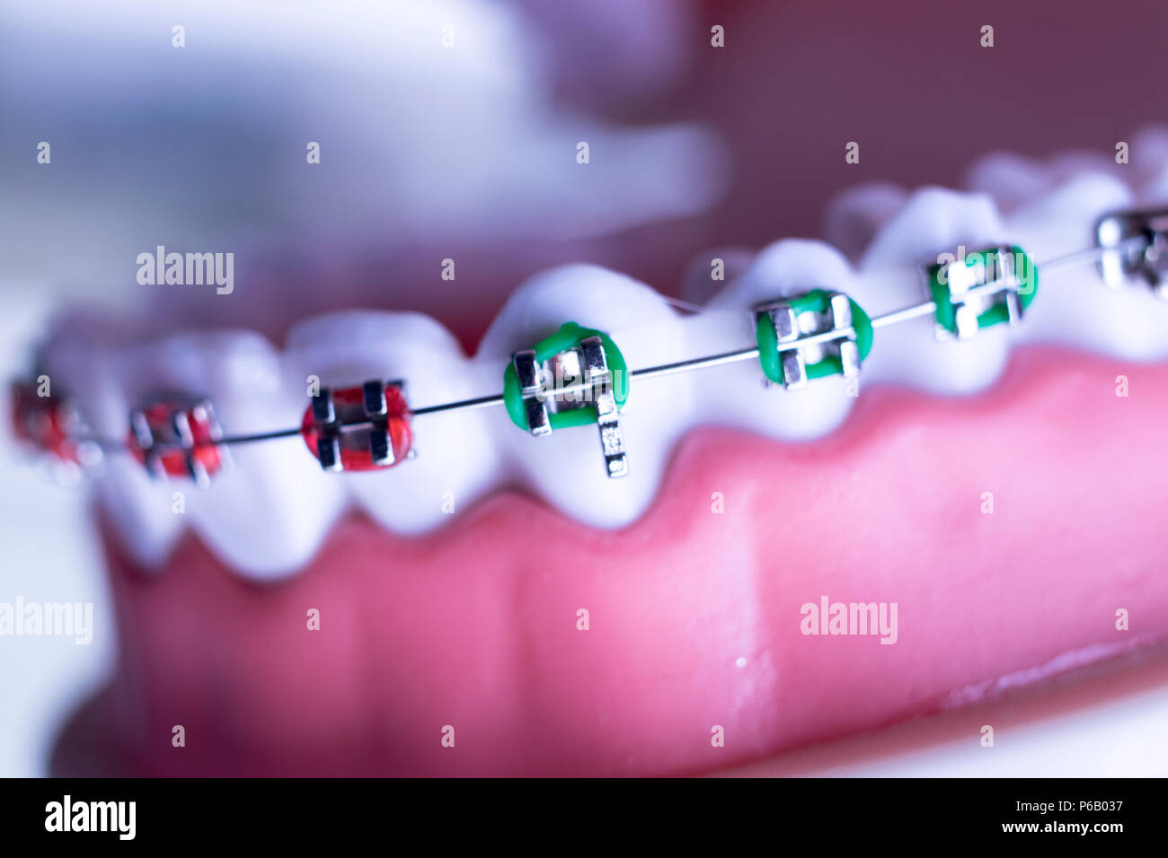 Dental metal braces teeth retainer aligners teaching orthodontics model