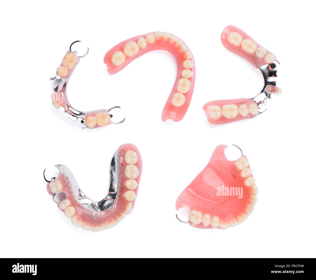 Бюгельный съемный протез на замках bredent. Бюгельный мостовидный протез. Бюгельный протез кламмер. Частичный съемный акриловый протез. Мост зубной бюгельный протез.