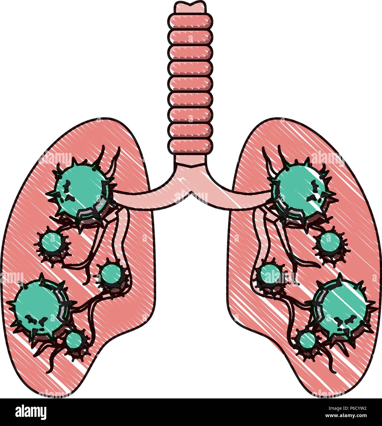 Respiratory Infection Stock Photos & Respiratory Infection Stock Images - Alamy1246 x 1390