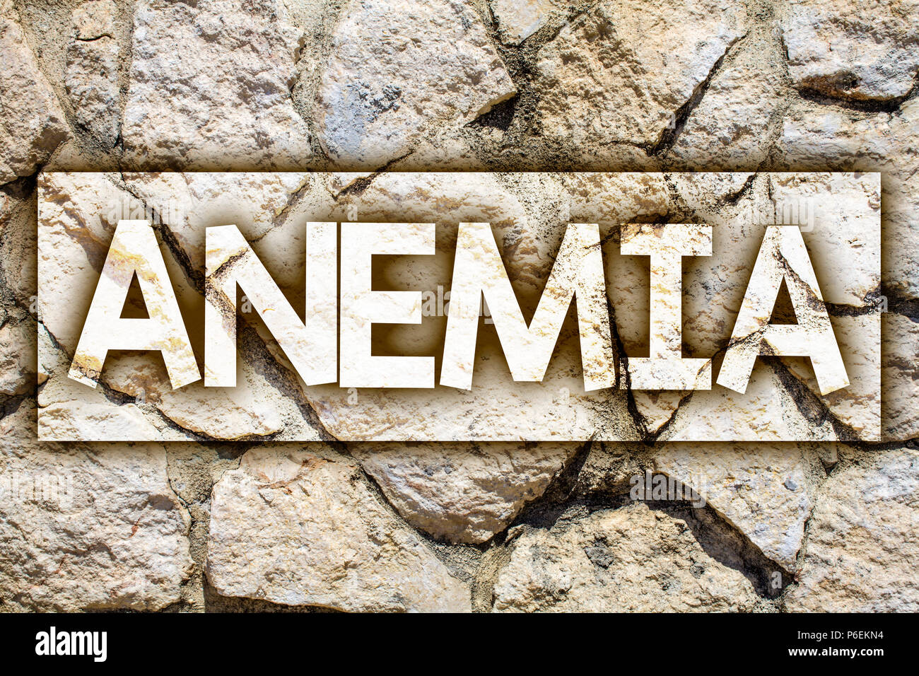 Writing note showing Anemia. Business photo showcasing Bloodlessness